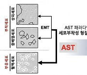 韓 연구진 “癌 전이 억제 새 원천기술 확보”