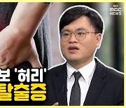 [약손+] 몸의 대들보 '허리'를 지켜라 ③추간판 탈출증