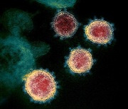 ‘코로나19+독감’ 동시감염 치명적 이유…바이러스 10배 폭증 확인