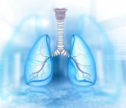 폐가 딱딱하게 굳는 '간질성 폐 질환’…10명 중 6명은 5년 내 사망