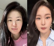 '김태현♥'미자, 충격적인 '화장 전후' 사진 공개…쌍커풀 수술 두번이나 했는데