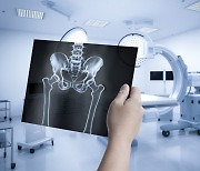 두통·어지럼 MRI 찍다가 '진료비 폭탄'…"건보 대상 아닙니다"