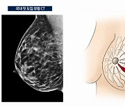 통증 없는 유방 검사 "이제 가능" [건강팁스터]