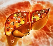 ‘이것’ 치료하면 ‘간암’ 위험↓