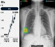 '암 정복의 꿈' 타고 3만원→11만원..300% 급등한 의료AI株 열풍