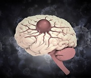 뇌종양의 ‘징조’, 두통·시력저하·기억장애…그리고?
