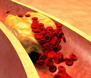 '나쁜' LDL 콜레스테롤의 역설…혈액 속에 너무 적어도 심혈관 질환 위험 높아진다