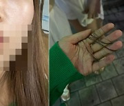 "입술 뚫린 딸, 돌려차기男 떠올라"…대전 무차별 폭행 '충격'