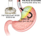 가톨릭대 공동 연구팀, '식욕증가 세포 억제' 비만 치료법 개발