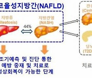 비알코올지방간질환 환자, 간 섬유화 진행 막으려면 '근육의 질' 중요