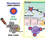 KAIST, 나노입자 기반 경구용 염증성 장 질환 치료제 개발