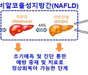 근육도 '양보다 질'…간경화·당뇨 막는다