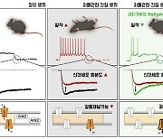 자폐 동반되는 `뇌전증` 약물 치료길 열리나