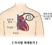 "제세동기 심은 환자, 우울증·불안장애 가능성"