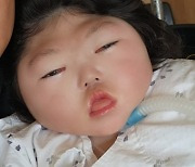 생후 5일 사고로 의식불명 3살 아영이…장기기증으로 4명 살려