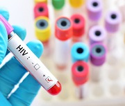 지난해 HIV 신규감염 1066명…검사량 늘며 전년보다 9% 증가