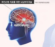 시간 지난다고 절로 낫지 않는 파킨슨병…방치는 금물