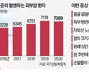 일광욕 후 점점 커지는 점·손발톱에 검은색 선…혹시 피부암일까?