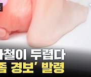 [자막뉴스] 무좀 없애는 법? 장마철이 최대 고비인 이유