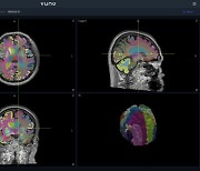 뷰노, AAIC 2023서 AI 기반 치매 연구결과 발표
