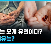 치매는 모계 유전이다? 그 이유는? [뽀얀거탑]