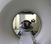 단순 두통 MRI, 10월부턴 건강보험 적용 안돼