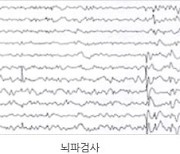 "치매 조기 진단 특수 뇌전도 개발"