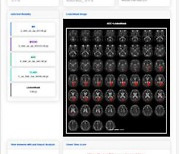 뇌경색 진단보조·시지각 훈련 소프트웨어 혁신의료기기 지정
