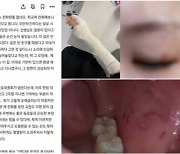 교사폭행 초교생 고발 당한다…학교측 '교권침해'로 고발 요청