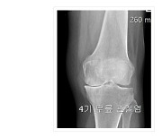 잘 걷는게 이렇게 행복한 일인지 몰랐어요 [ 만성통증을 해결은 척추와 골반의 정렬 해결이 먼저입니다.]