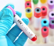 HIV 감염인 적절한 치료 받으면 성관계도 안전 (연구)