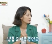 [종합] 박선영, 촬영 도중 종아리 근육 파열 고백 “6개월 쉬라더라”(옥문아)