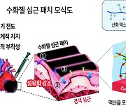 “심장에 바르면 심근경색 걱정 끝” 수화젤 심근패치 개발