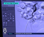 "골든타임 지켜라"...충북, '전원율' 1위 불명예