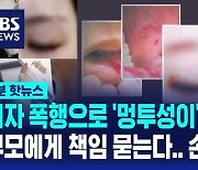 [1분핫뉴스] 6학년에 맞아 멍투성이 된 교사, 학부모에 손배 소송