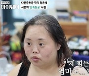 정은혜 母 “시선 공포증+조현병 증세 20대 딸, 돌보다 뇌졸중 왔다” (‘마이웨이’)[Oh!쎈 포인트]