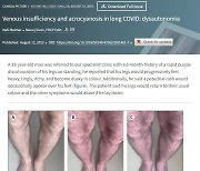 내 다리 이렇다면?…새 '코로나 장기 후유증' 의심