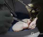 Pig Human Transplants