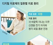 뇌졸중·우울증도 전기자극으로 고친다, 약물 대신 뜨는 치료제는