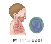 美 소아과 학회, 모든 영아에 RSV 예방백신 접종 권고