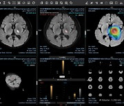 제이엘케이 "AI 뇌졸중 솔루션, 실증 마무리 단계…160개 병원 설치"