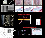 전남대 연구팀, ‘무릎연골 치료’ 첨단 나노소재 기술 개발