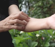 질병관리청, 뎅기열 사망 사례 확인..위험지역서 모기 물리지 않도록 주의해야