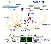 새 치매 치료제 길 열리나... 국내 연구진, 치매 발병 기전 규명