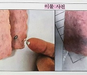 급식에 나온 유명 햄 자르자, 흰 덩어리가…돼지 지혈제였다