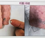 "오늘도 먹었는데"···유명 햄서 나온 '정체 불명' 흰 덩어리 알고 보니···