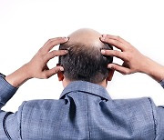 Development of hair loss treatments speeds up as market grows