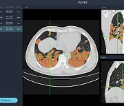 Korean medical AI stocks rise sharply in September to date