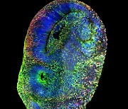 [사이언스샷] 미니 뇌로 자폐 유전자 36개 동시에 규명