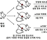 강남세브란스, 유방암 표적항암치료 무력화 유전자 규명